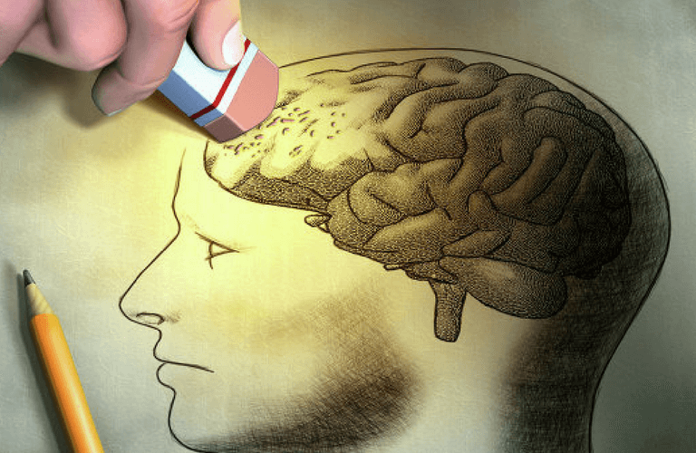 Alzheimer Alzheimer